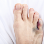 how long does a broken toe take to heal